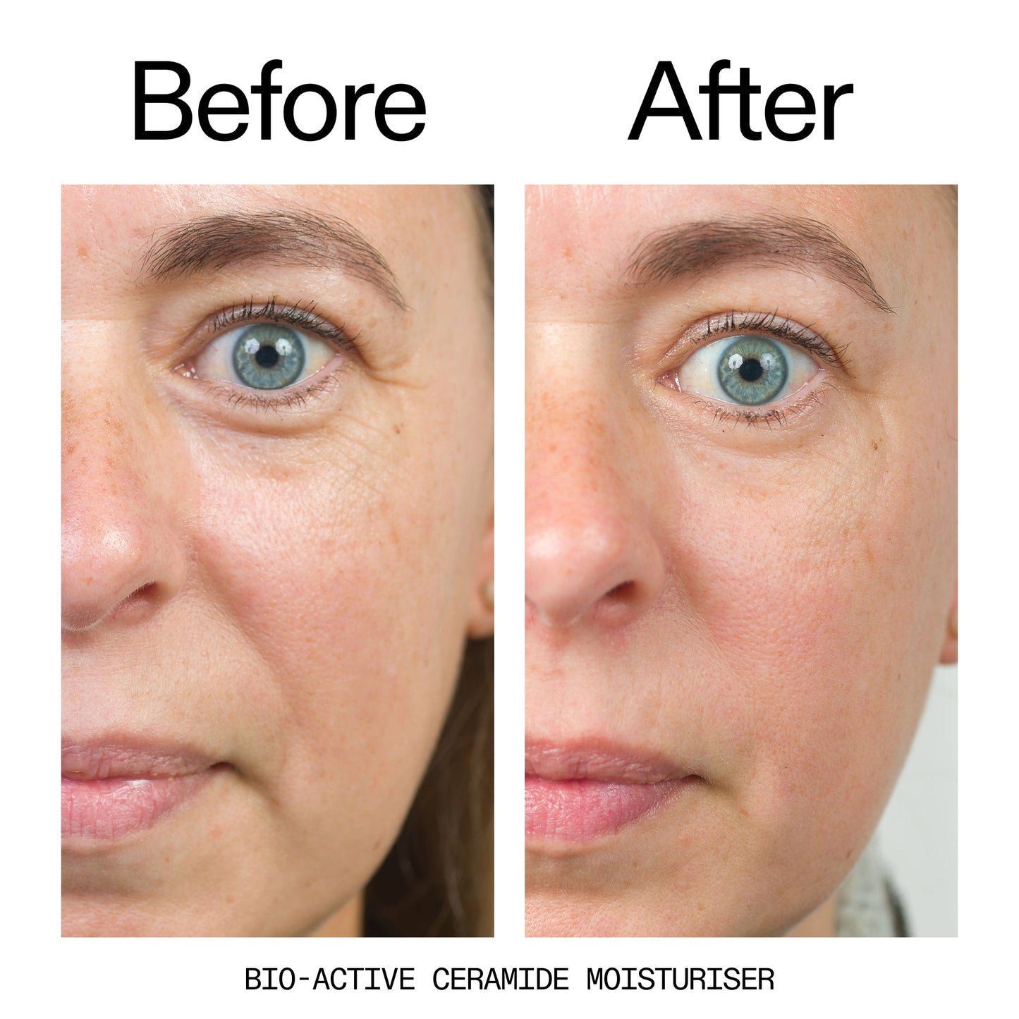 barrier-boosting-trio-m9 Bio-Active_Before_After_2000x2000_600947b4-e8c5-425a-9155-fc15bc83aa12.jpg