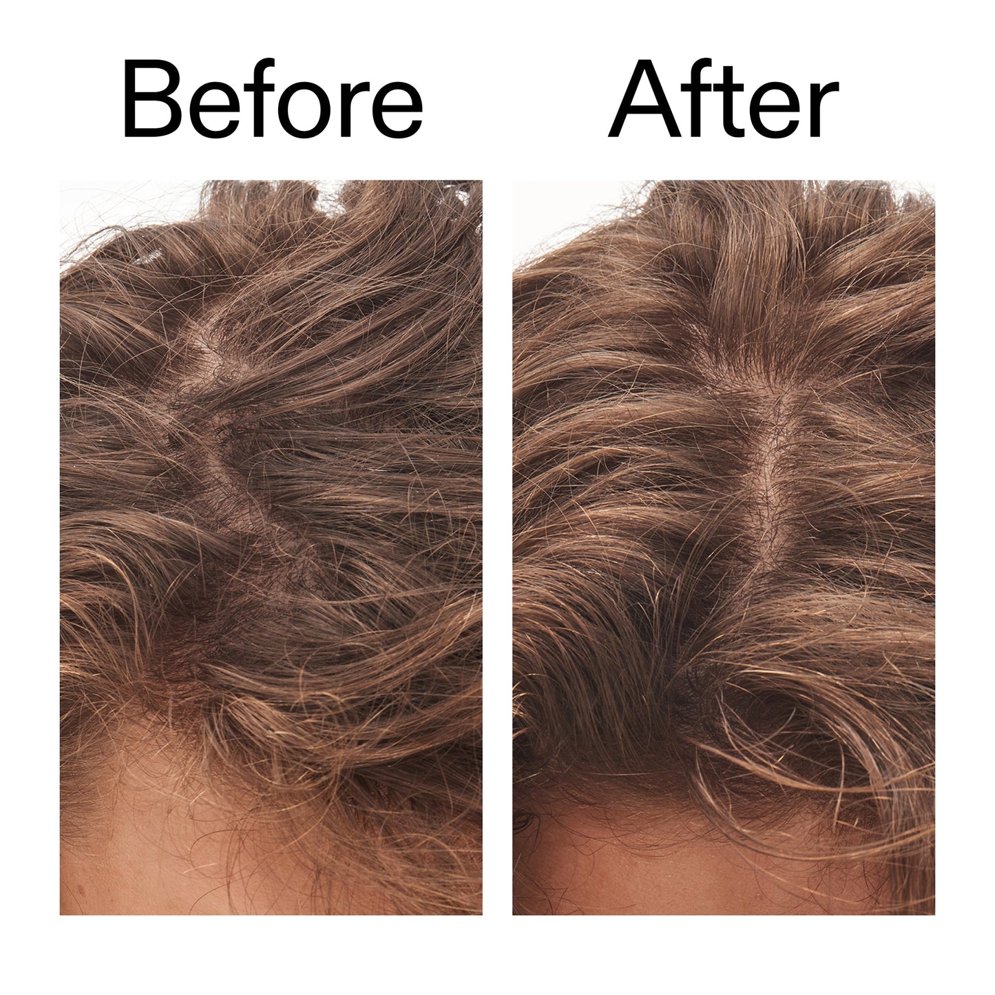glycolic-acid-exfoliating-scalp-scrub-y4 Glycolic_Acid_Exfoliating_Scalp_Scrub_Before_After_2000x2000_b8561c87-05a1-4caa-80f7-1b6b33d750f7.jpg