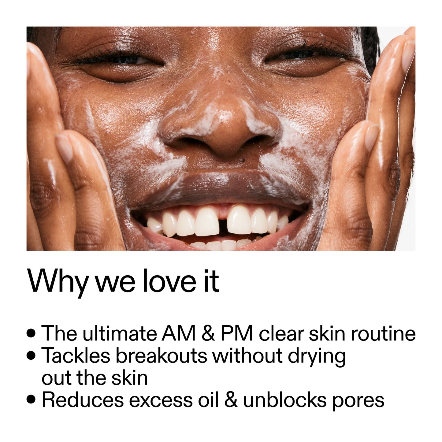 intro-routine-for-acne-h2 Intro_Routine_for_Acne_Why_we_love_it_2000x2000_42499e10-4629-4a0e-a627-7e215f4da6bc.jpg