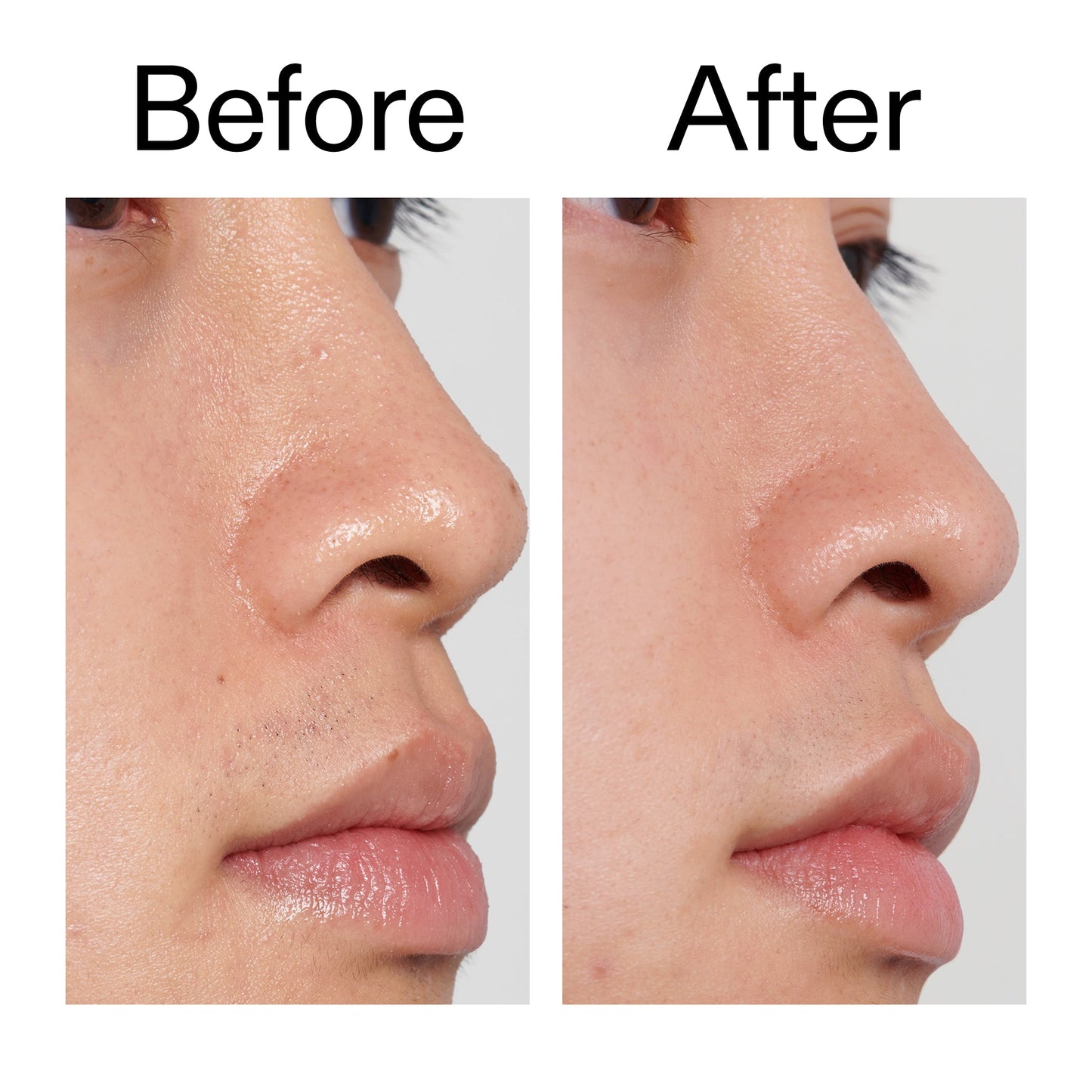 pha-toner-l1 PHA_Toner_Before_After_2000x2000_e3c10172-0150-4342-8b95-57417eaff50d.jpg