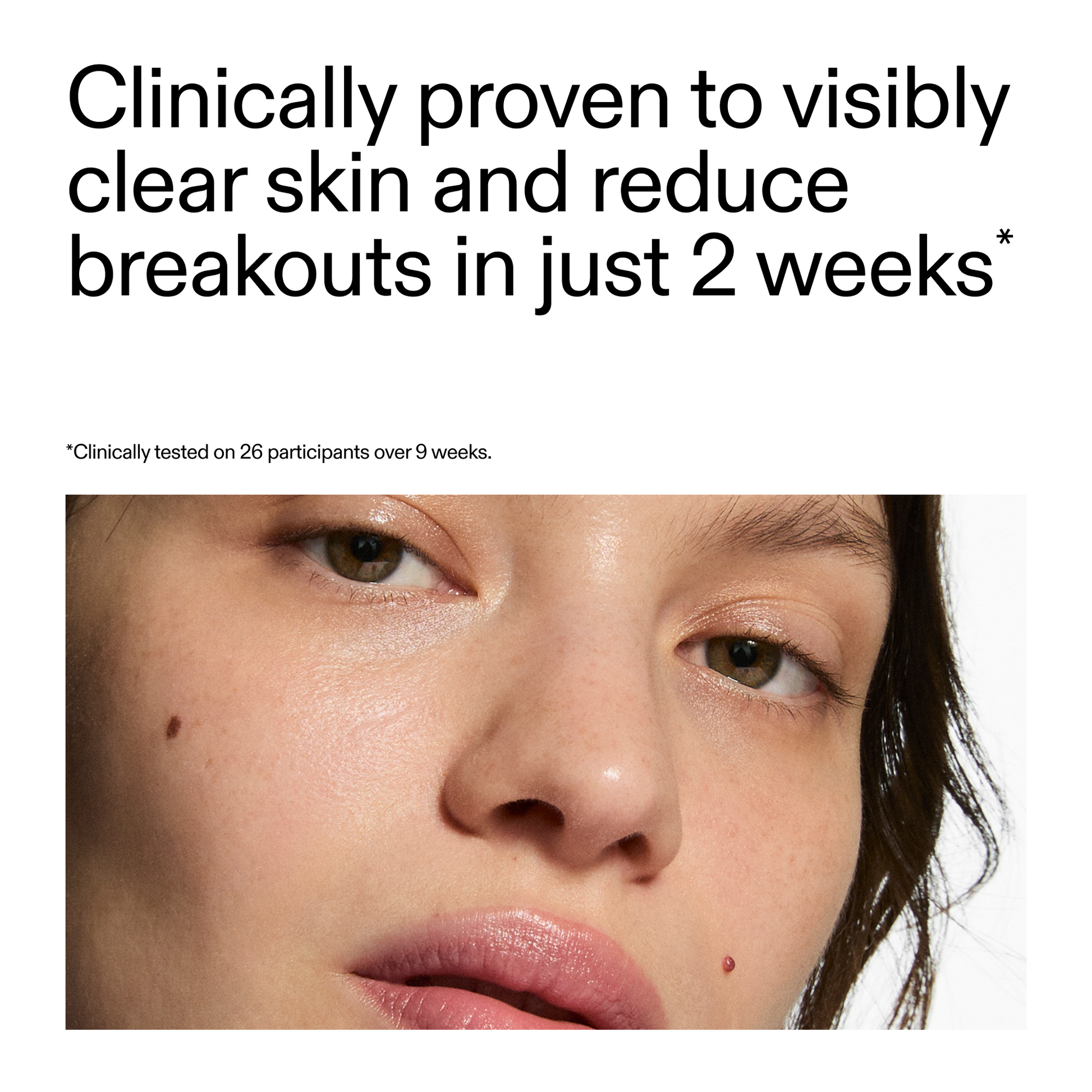 360-acne-clearing-duo-f0 360_Serum_Key_Claim.png