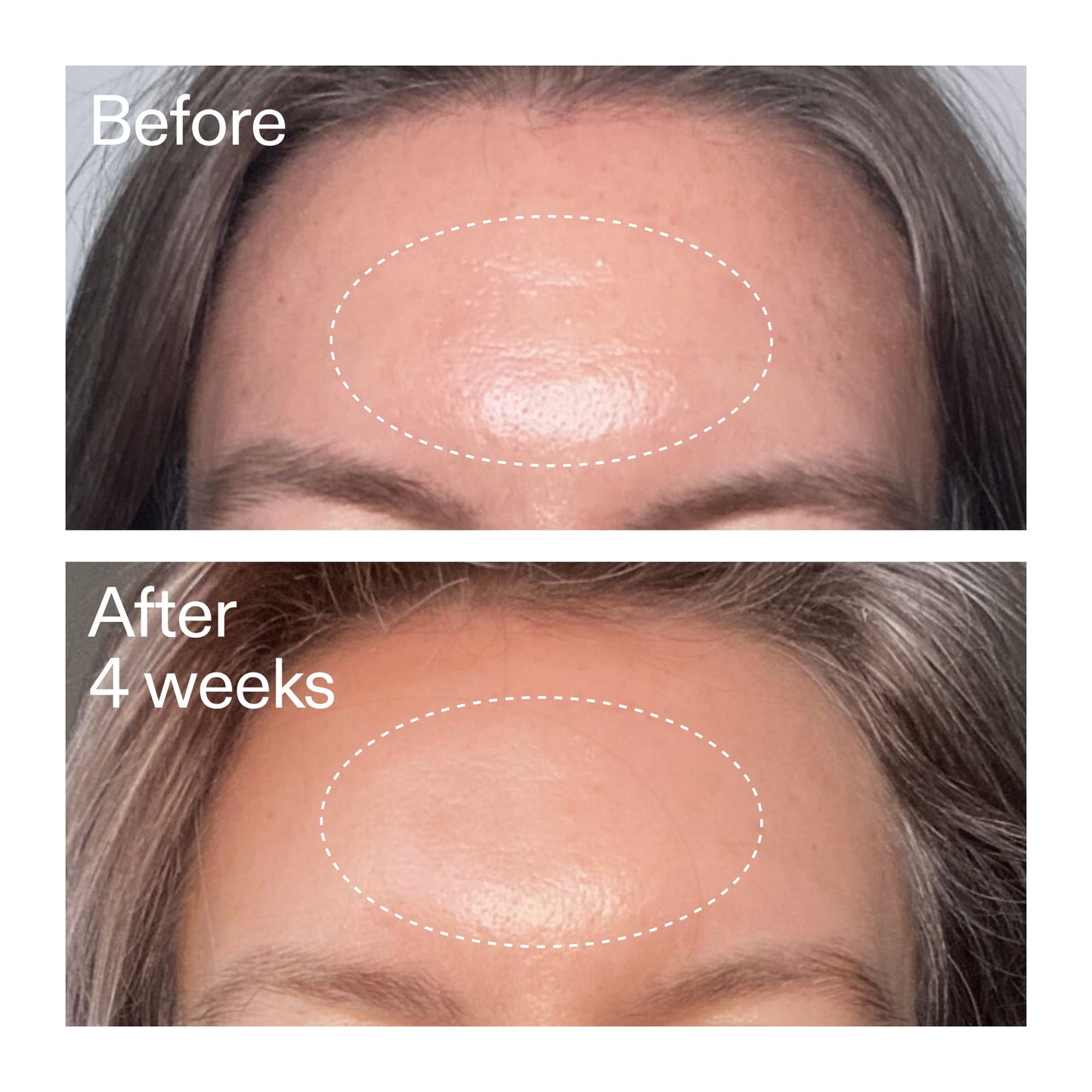 advanced-0-2-retinal-serum-duo-b8 AdvancedRetinal_BeforeAfter1_2000x2000_4e9c798a-f30e-45b8-a34a-7c4740f2f2cb.jpg