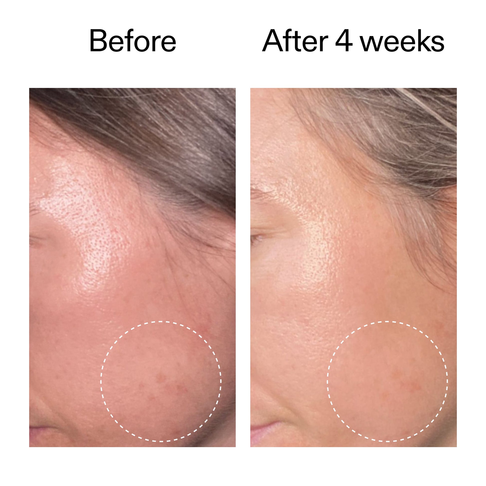 advanced-0-2-retinal-serum-d6 AdvancedRetinal_BeforeAfter2__2000x2000_62fb16bb-77ae-4d63-8500-88dbf847f4b9.jpg