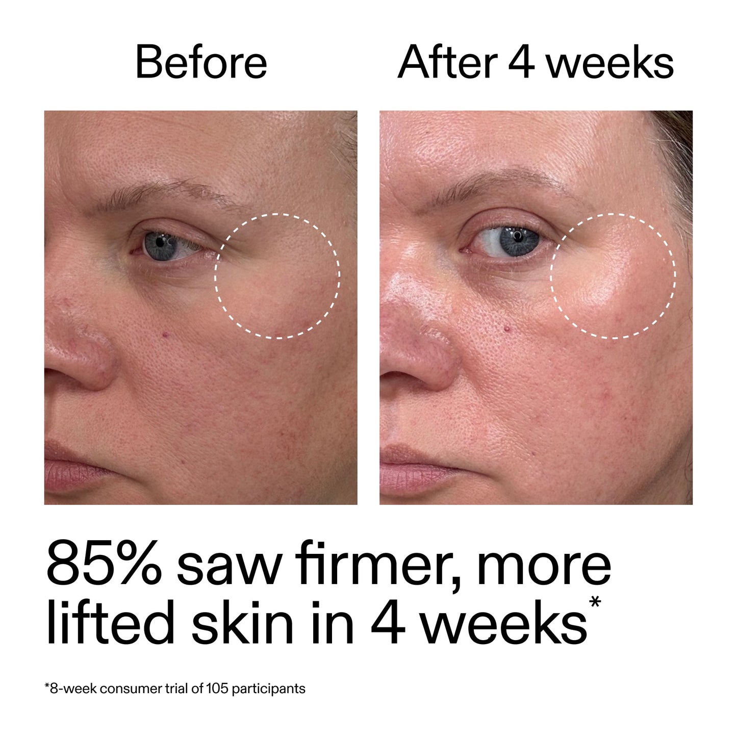 advanced-0-2-retinal-serum-duo-b8 AdvancedRetinal_BeforeAfter_Claim1_2000x2000_3a315aa8-f408-4b33-bbeb-0d9209f98404.jpg