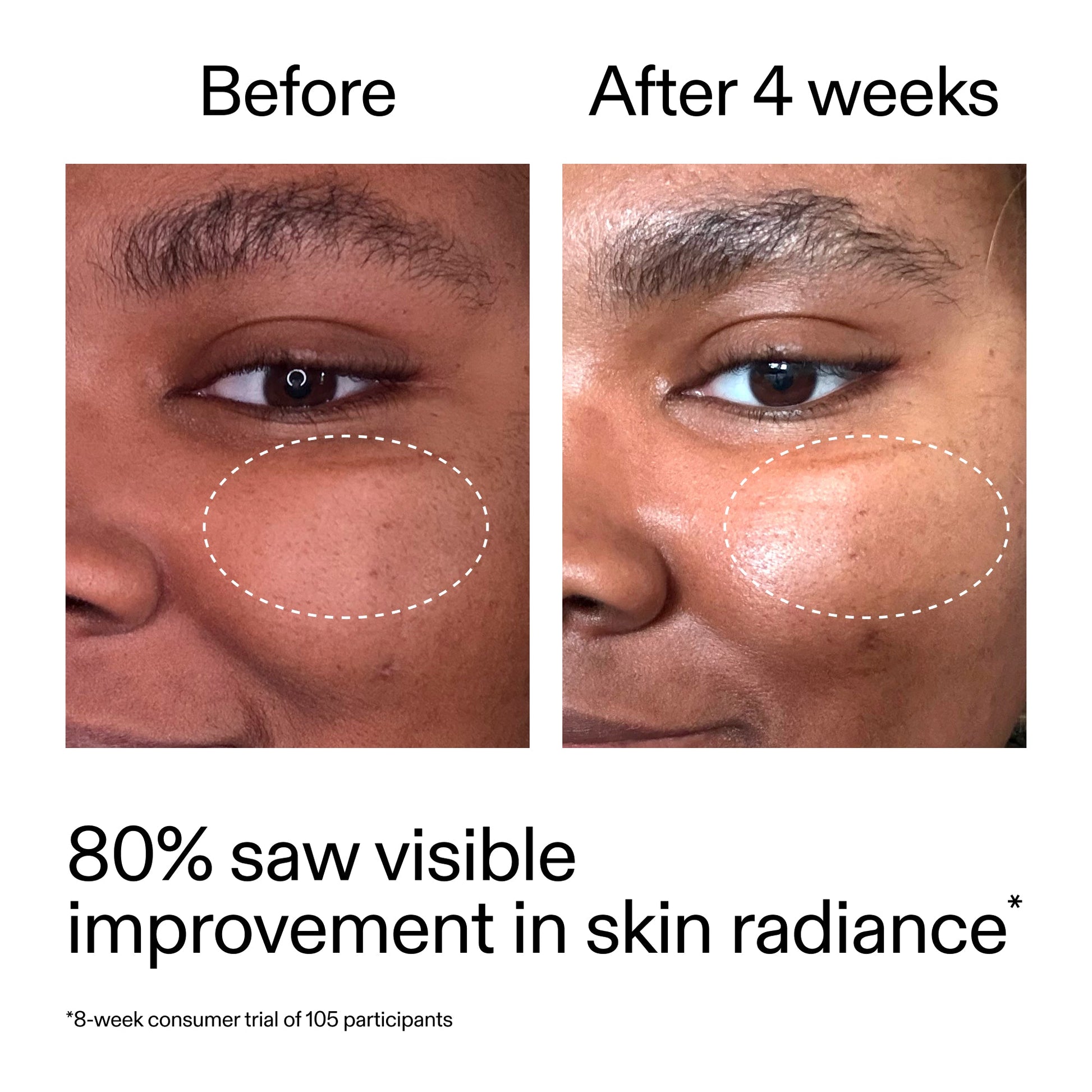 advanced-0-2-retinal-serum-d6 AdvancedRetinal_BeforeAfter_Claim2_2000x2000_39d11e3d-eda9-44ec-ab32-2903b1a368bd.jpg