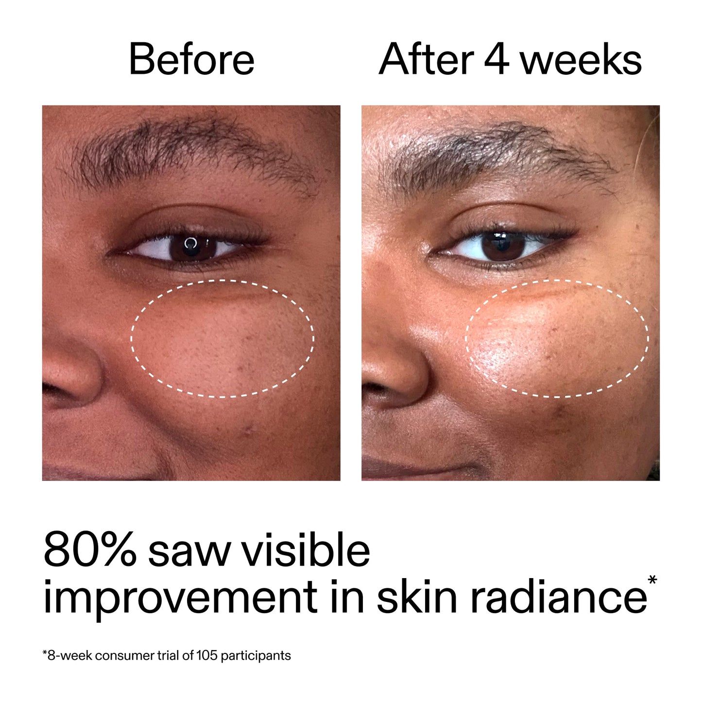 advanced-0-2-retinal-serum-duo-b8 AdvancedRetinal_BeforeAfter_Claim2_2000x2000_681b621d-8d44-4d44-9a40-89244f9b2e53.jpg