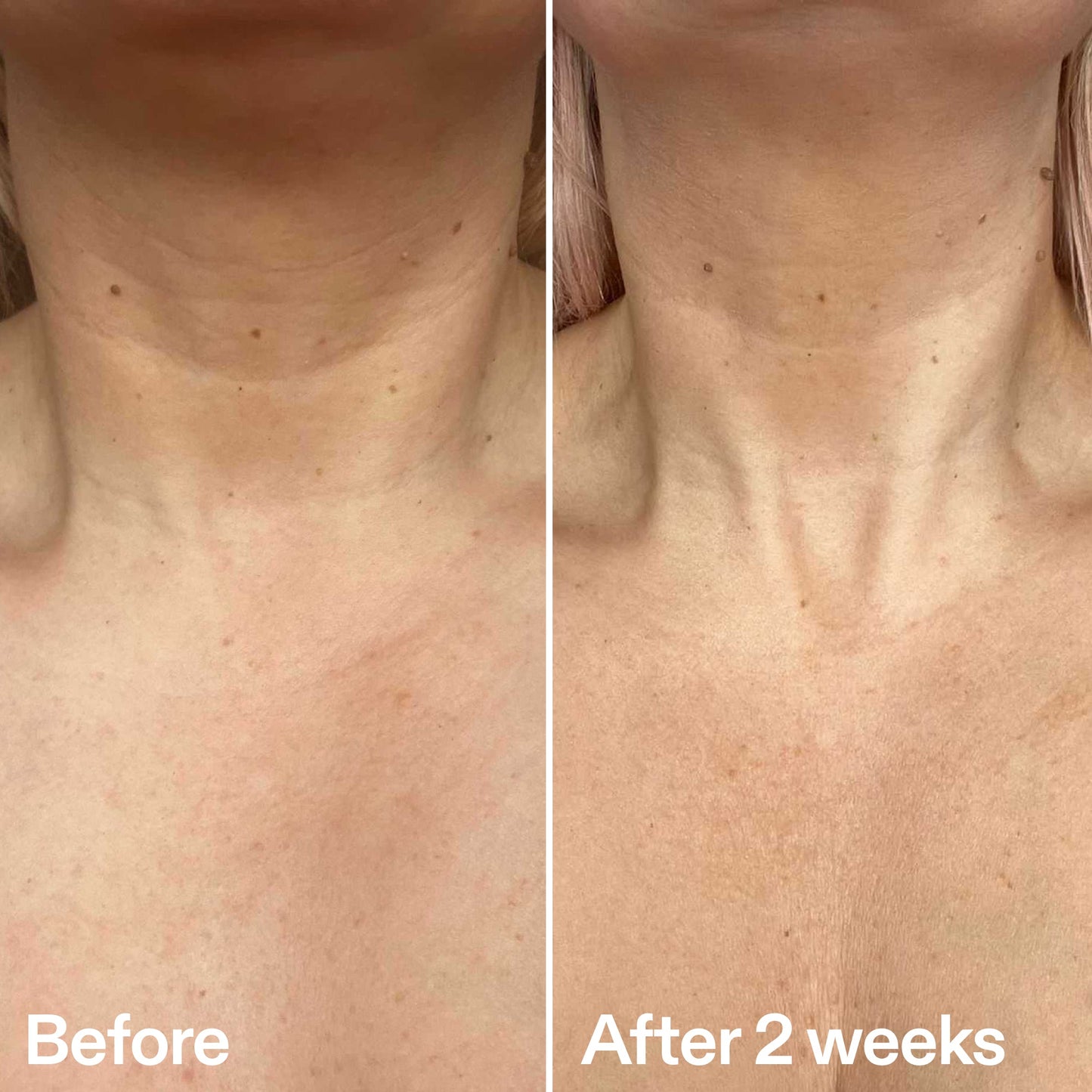 bio-active-neck-lift-stick-j7 B_A_2.jpg