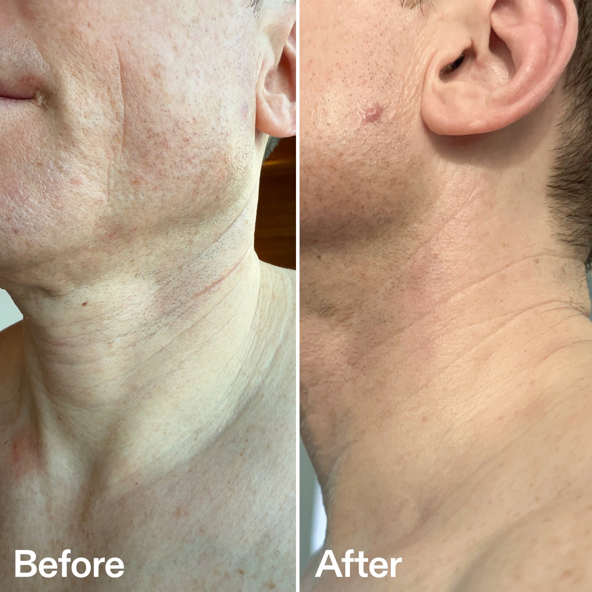 bio-active-neck-lift-stick-j7 B_A_afa2743e-b8e2-4504-92f4-e281cb6cf759.jpg
