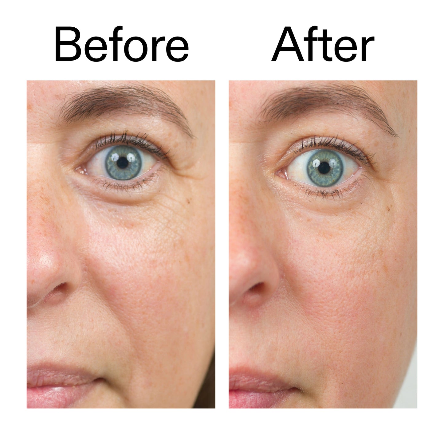 bio-active-ceramide-moisturizer-duo-j6 Bio-Active_Before_After_2000x2000_566e5a9e-135e-417a-8242-b44e5fa35463.jpg