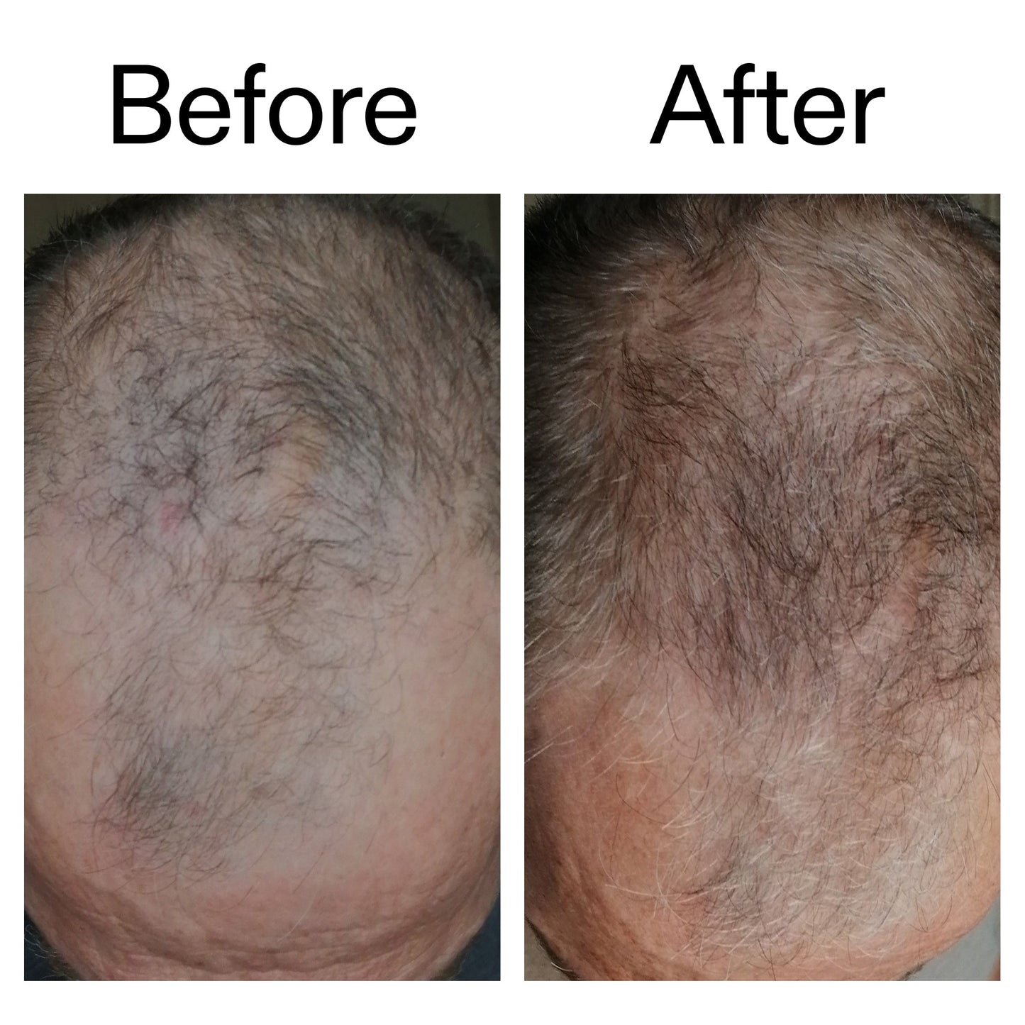 3-month-hair-growth-trio-t9 Caffeine_Scalp_Treatment_B_A_Ppage_2000_x_2000.jpg