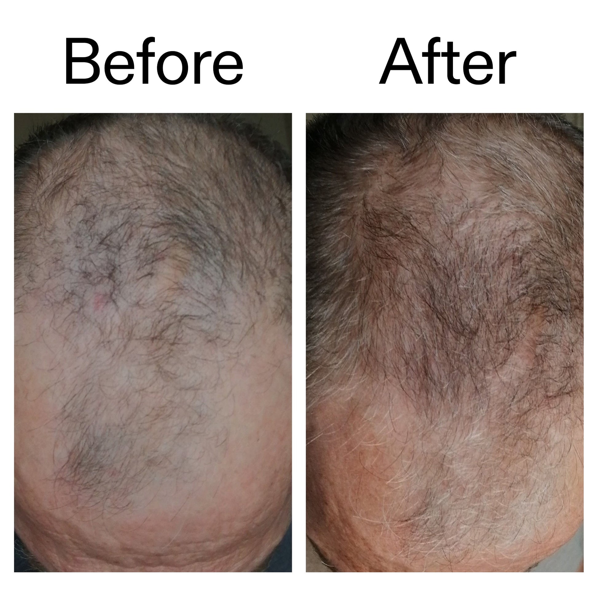 3-month-hair-growth-trio-t9 Caffeine_Scalp_Treatment_B_A_Ppage_2000_x_2000.jpg