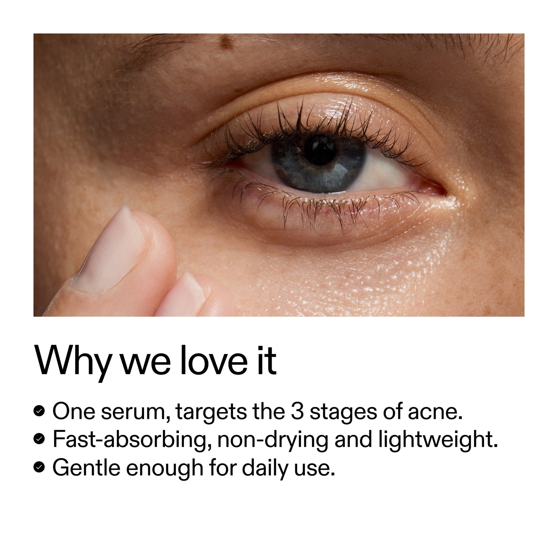 360-acne-clearing-duo-f0 Dioic_Whyweloveit_2000x2000_175aafd3-0cbe-403a-b317-a8362881bfe2.jpg