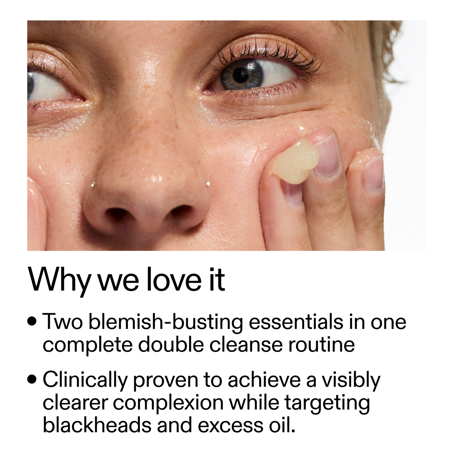 acne-double-cleanse-duo-l6 Double_Cleanse_Duo_for_Breakouts_Why_We_2000x2000_f242cb12-bb5c-487c-b203-071ccb406ec5.png