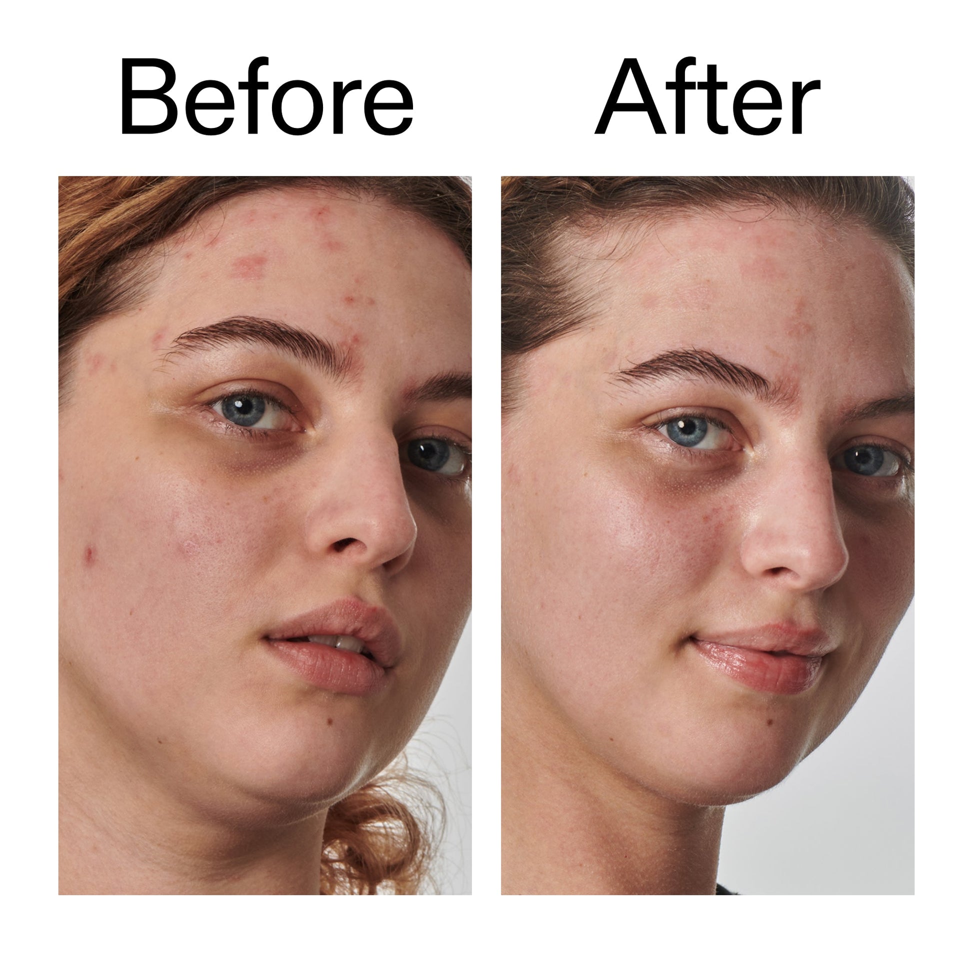 10-urea-moisturizer-d2 Dry_and_Rough_Skin_Solution_Before_After_2000x2000_efa6e639-5c39-49bd-a5dd-f0220293120a.jpg