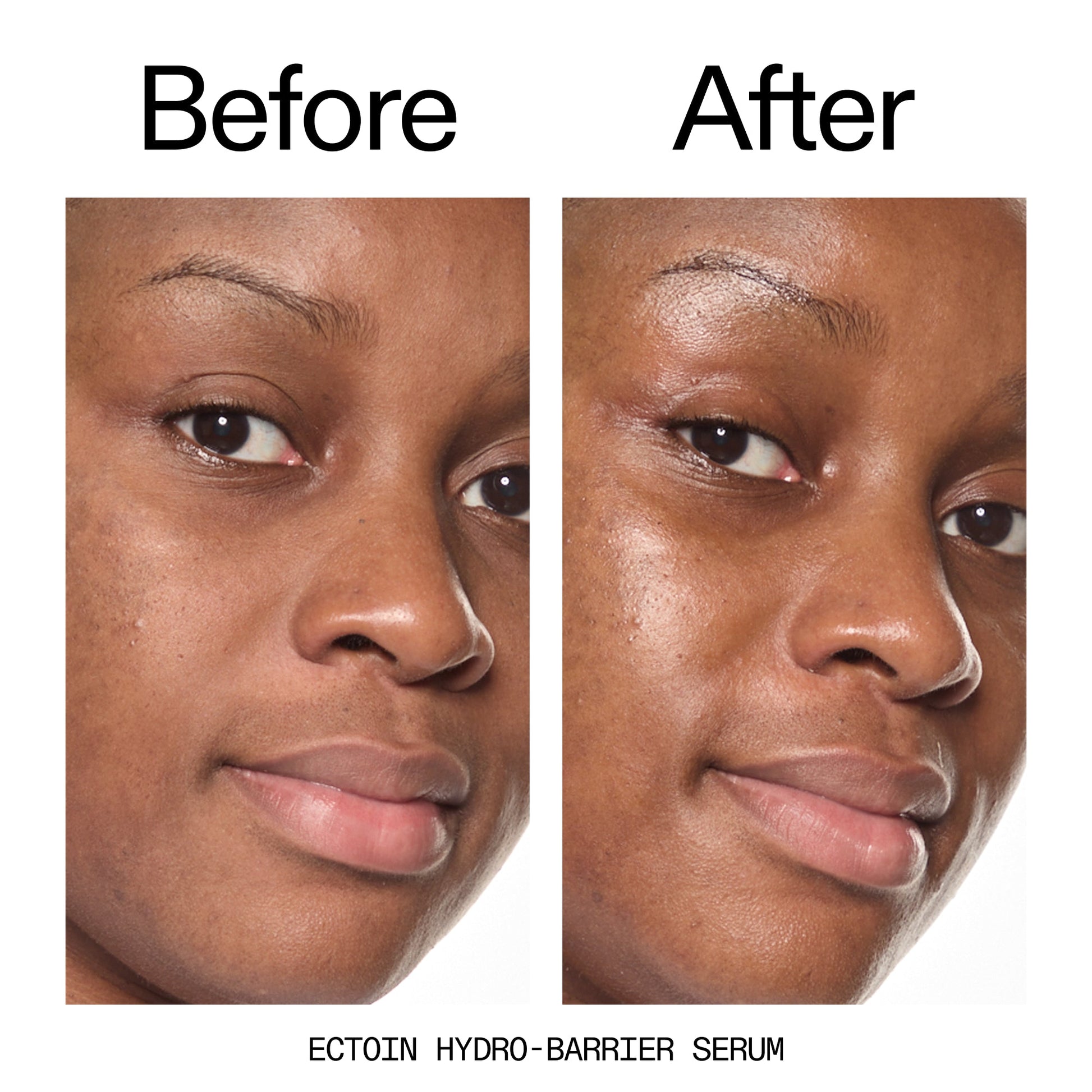 barrier-boosting-trio-m9 Ectoin_Before_After_2000x2000_ce35bc41-4da0-4b6f-adc7-29f8641f6c6c.jpg