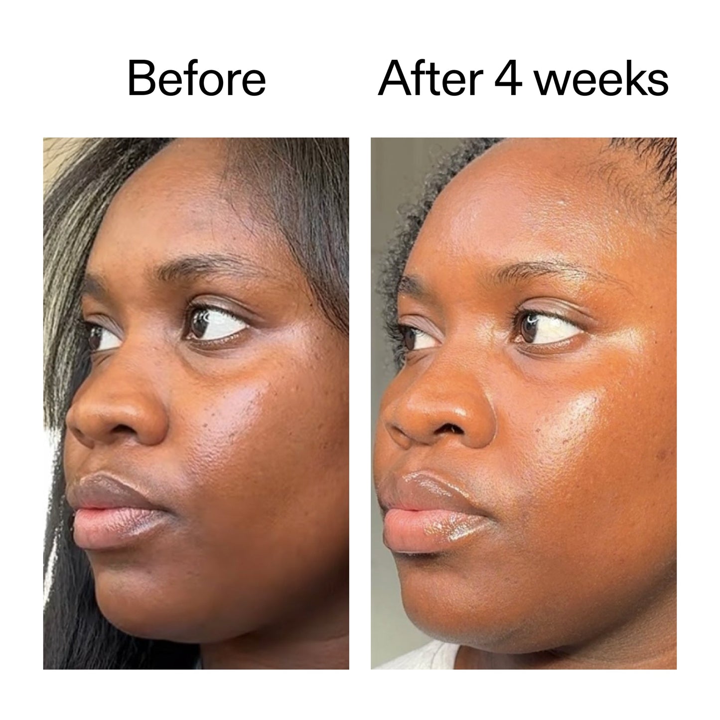 exosome-hydro-glow-complex-duo-t6 Exosome_Before_After_V12_2000x2000_2e7d50e1-0ed9-4624-91c6-1f94c0266a04.jpg