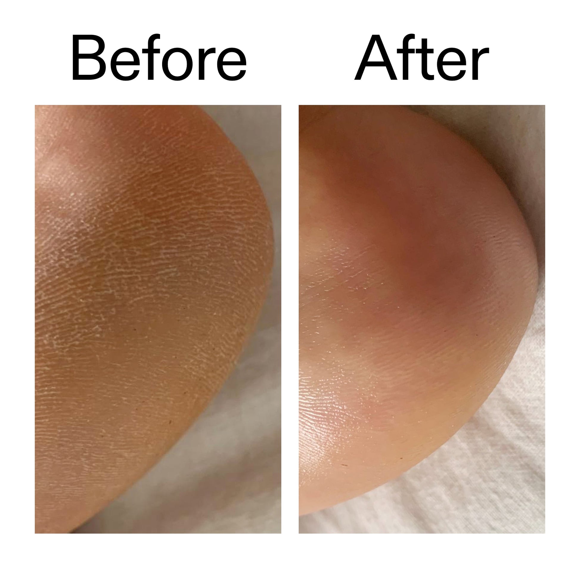 glycolic-acid-exfoliating-body-stick-d3 Glycolic_Acid_Exfoliating_Body_Stick_Before_After_V1_2000x2000_a3043625-9400-429a-a7fb-d6dbd220f722.jpg