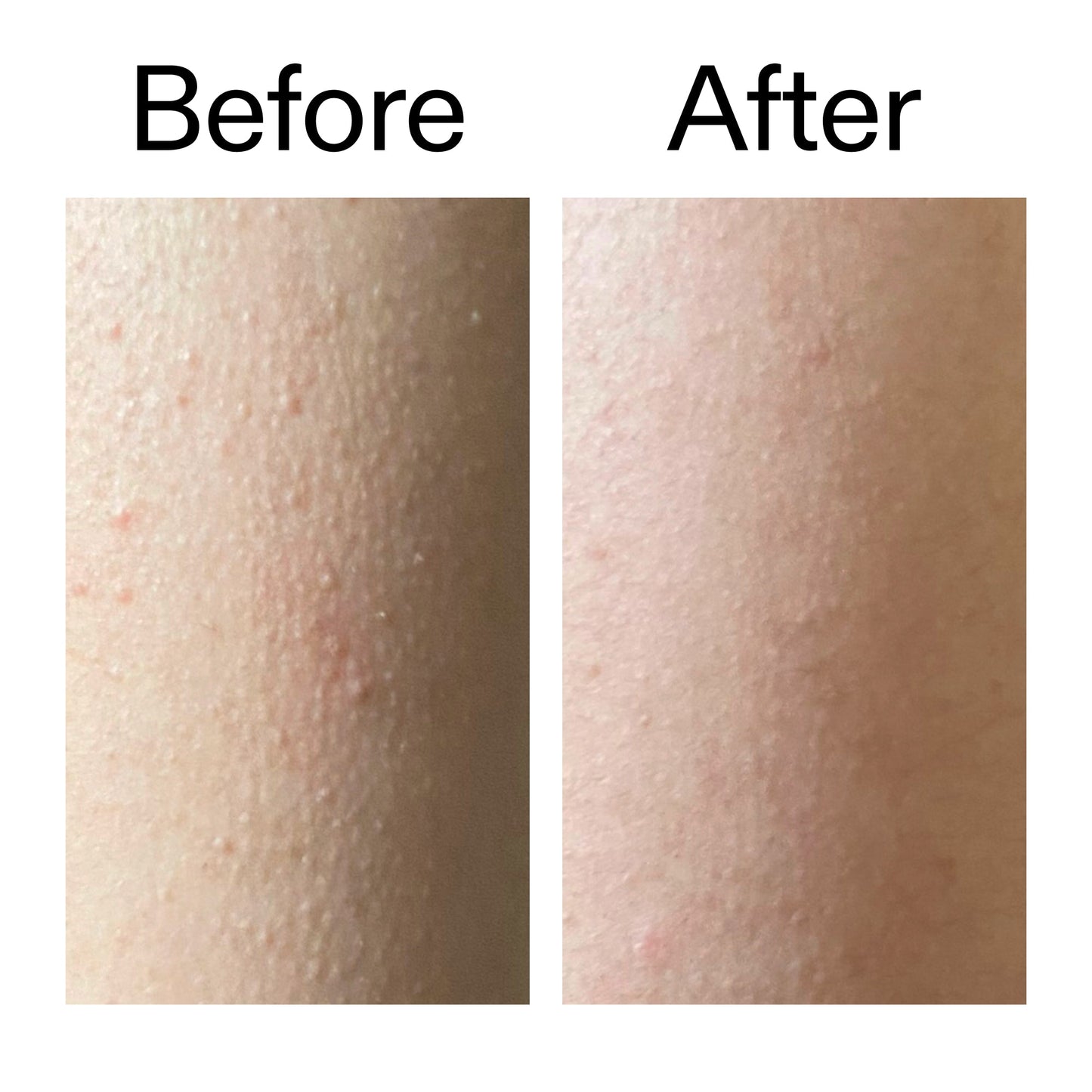 glycolic-acid-exfoliating-body-stick-d3 Glycolic_Acid_Exfoliating_Body_Stick_Before_After_V2_2000x2000_2e4ba052-94f6-4d56-82df-7bdb5b2df7ae.jpg