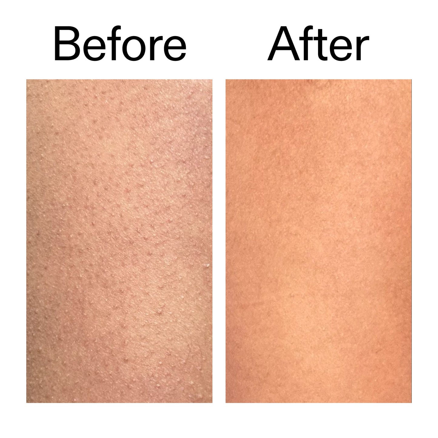 glycolic-acid-exfoliating-body-stick-duo-u1 Glycolic_Body_Stick_B_A_2000x2000_6e6e6b4d-5bd7-43c0-aeed-4d66788e8995.jpg