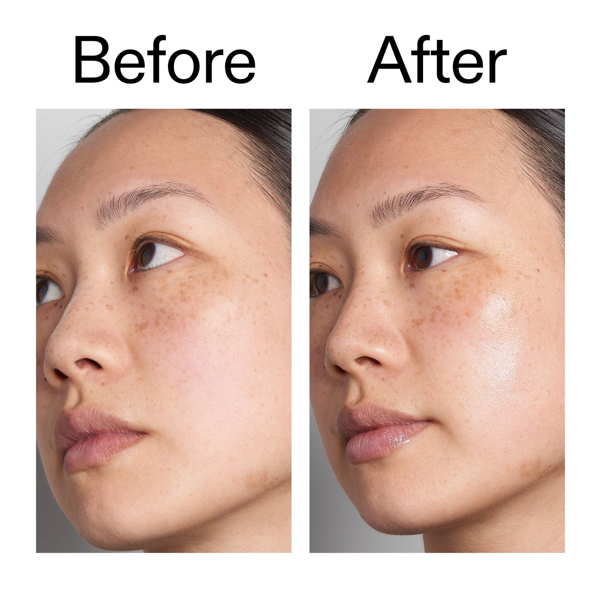 hyaluronic-acid-serum-60ml-r0 Hyaluronic_Acid_Before_After_2000x2000_d7983956-8aa2-4ea3-8255-c63e8d4f892e.jpg