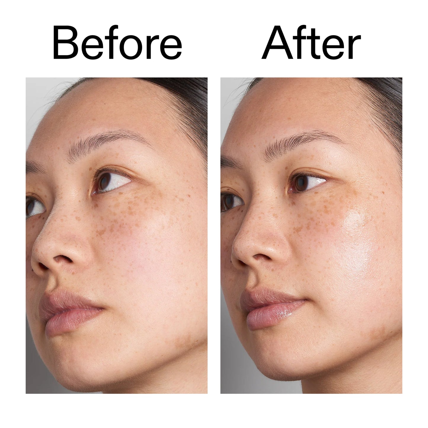 hyaluronic-acid-serum-30ml-e5 Hyaluronic_Acid_Before_After_2000x2000_d7983956-8aa2-4ea3-8255-c63e8d4f892e.jpg