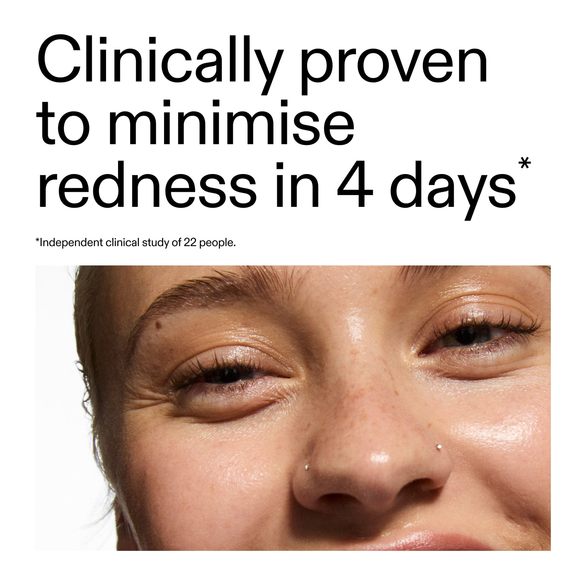 10-azelaic-acid-serum-for-redness-relief-k3 Oat_Cleansing_Balm_Claim_2000x2000_52a841dc-353c-4f2c-8646-3aadb604507d.jpg