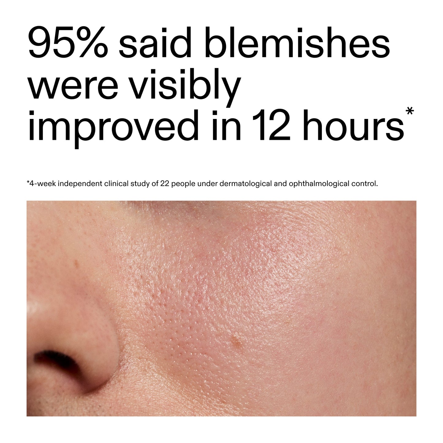 succinic-acid-acne-treatment-l0 Oat_Cleansing_Balm_Claim_2000x2000_ac6ce553-25db-41b2-a981-faae1ac4b8c0.jpg