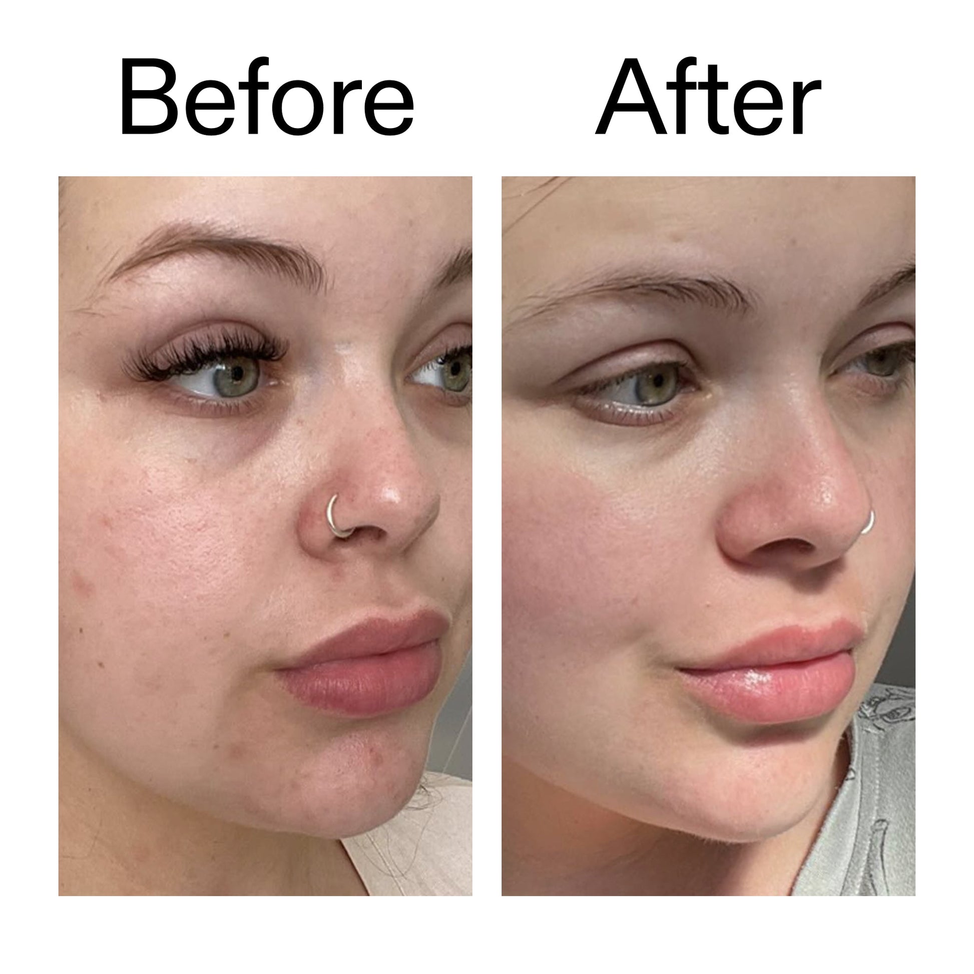 supersize-omega-water-cream-duo-d3 Omega50_Before_After_2000x2000_46483ed8-3f9d-487f-9a0c-9df79830bd65.jpg