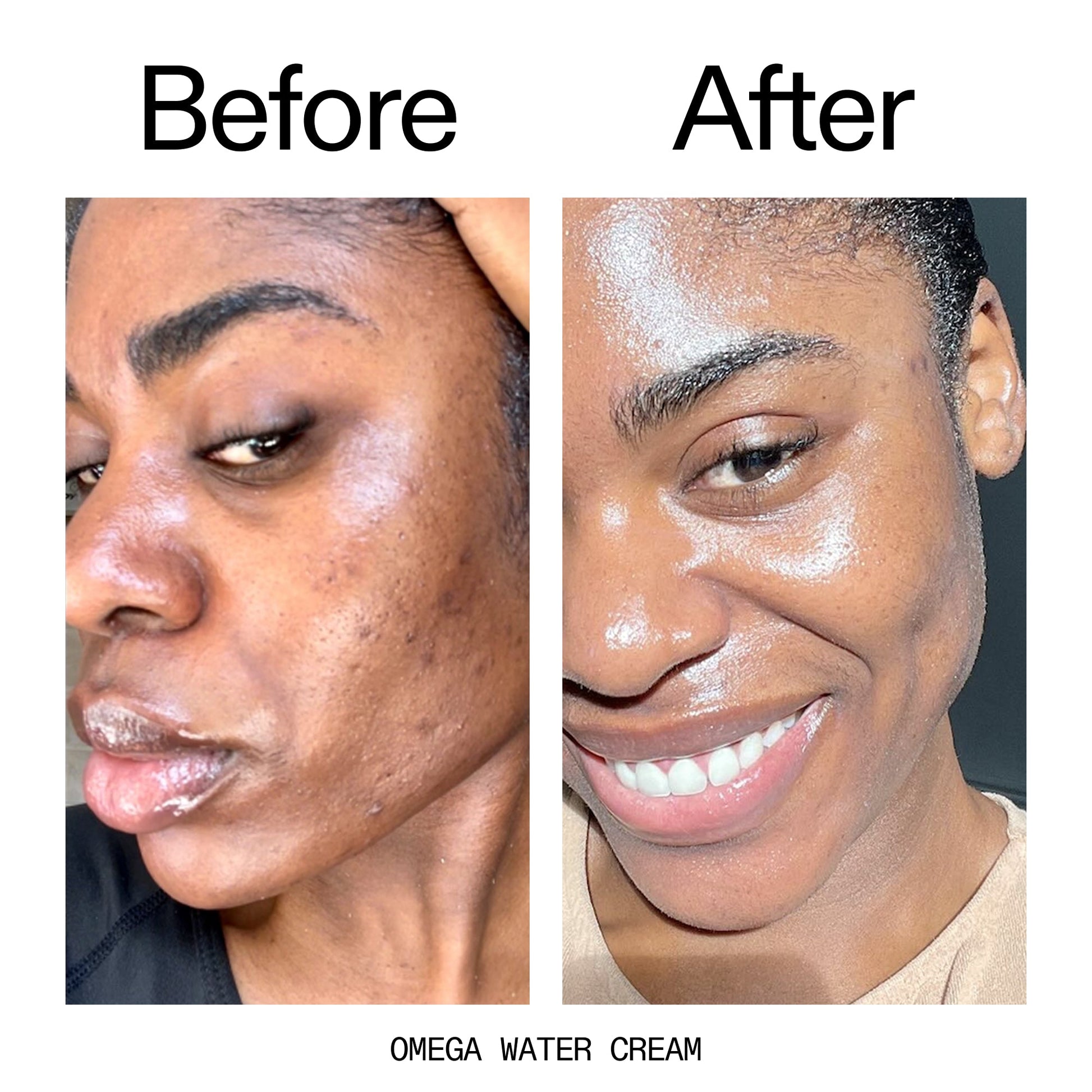 hydrating-cleanser-and-moisturizer-duo-j8 Omega_Water_Cream_Before_After_2000x2000_8e88278b-8c8d-48dc-ac77-4e98ebbd1b77.jpg