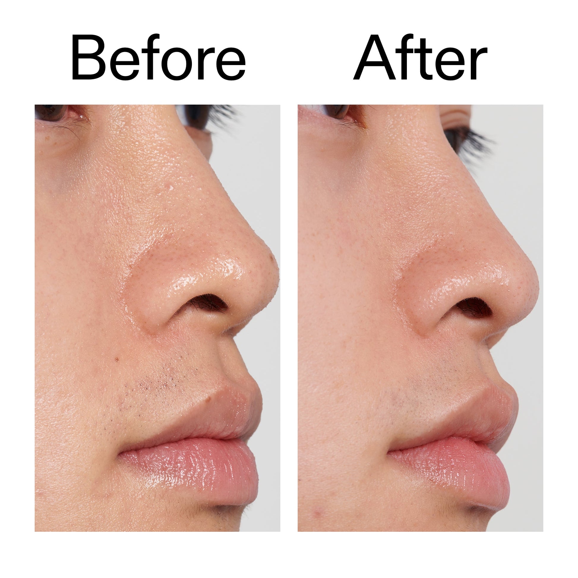 pha-toner-l1 PHA_Toner_Before_After_2000x2000_e3c10172-0150-4342-8b95-57417eaff50d.jpg