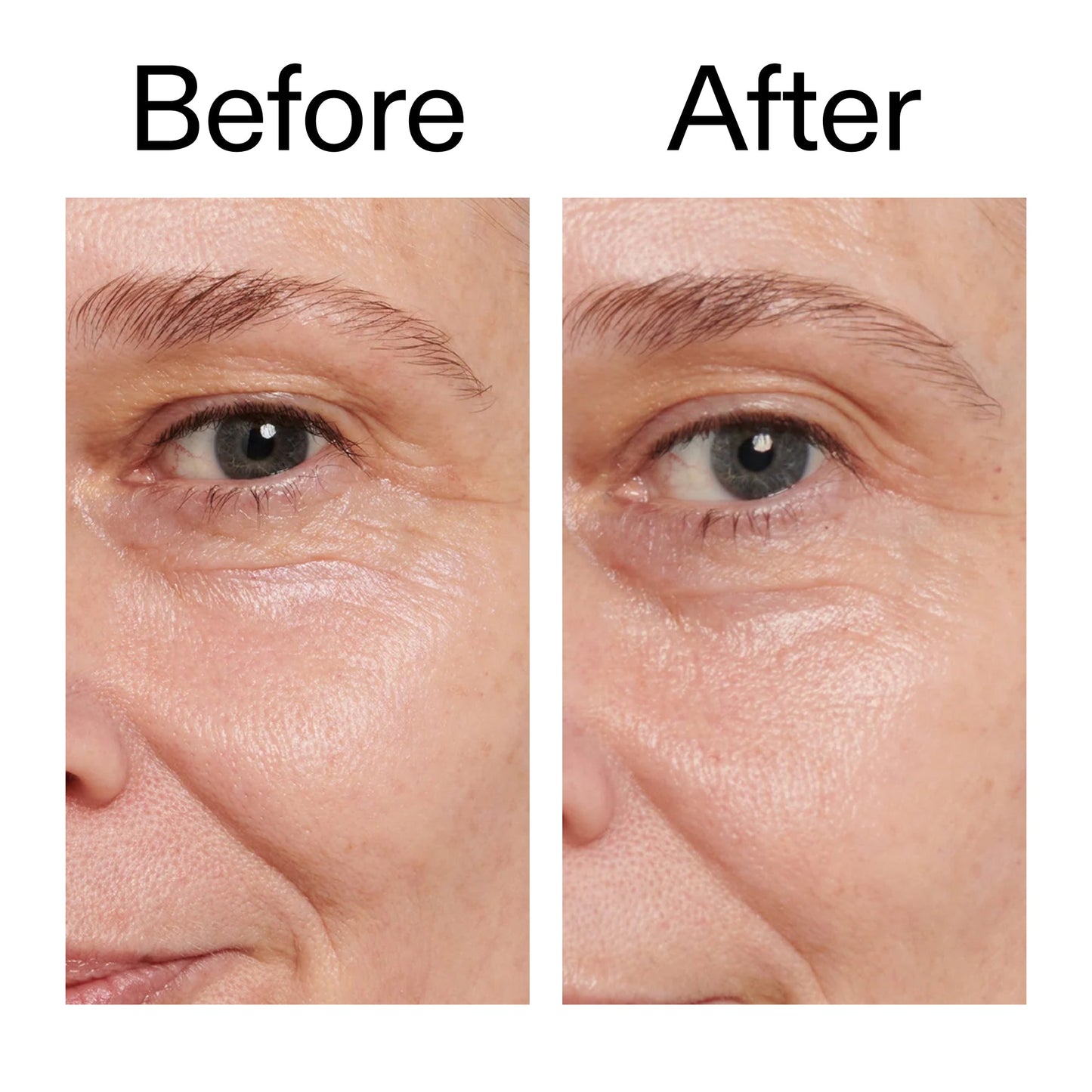 retinol-eye-cream-a4 Retinol_Eye_Cream_Before_After_2000x2000_ac03a80c-109e-4572-a95a-91dc109b4d27.jpg