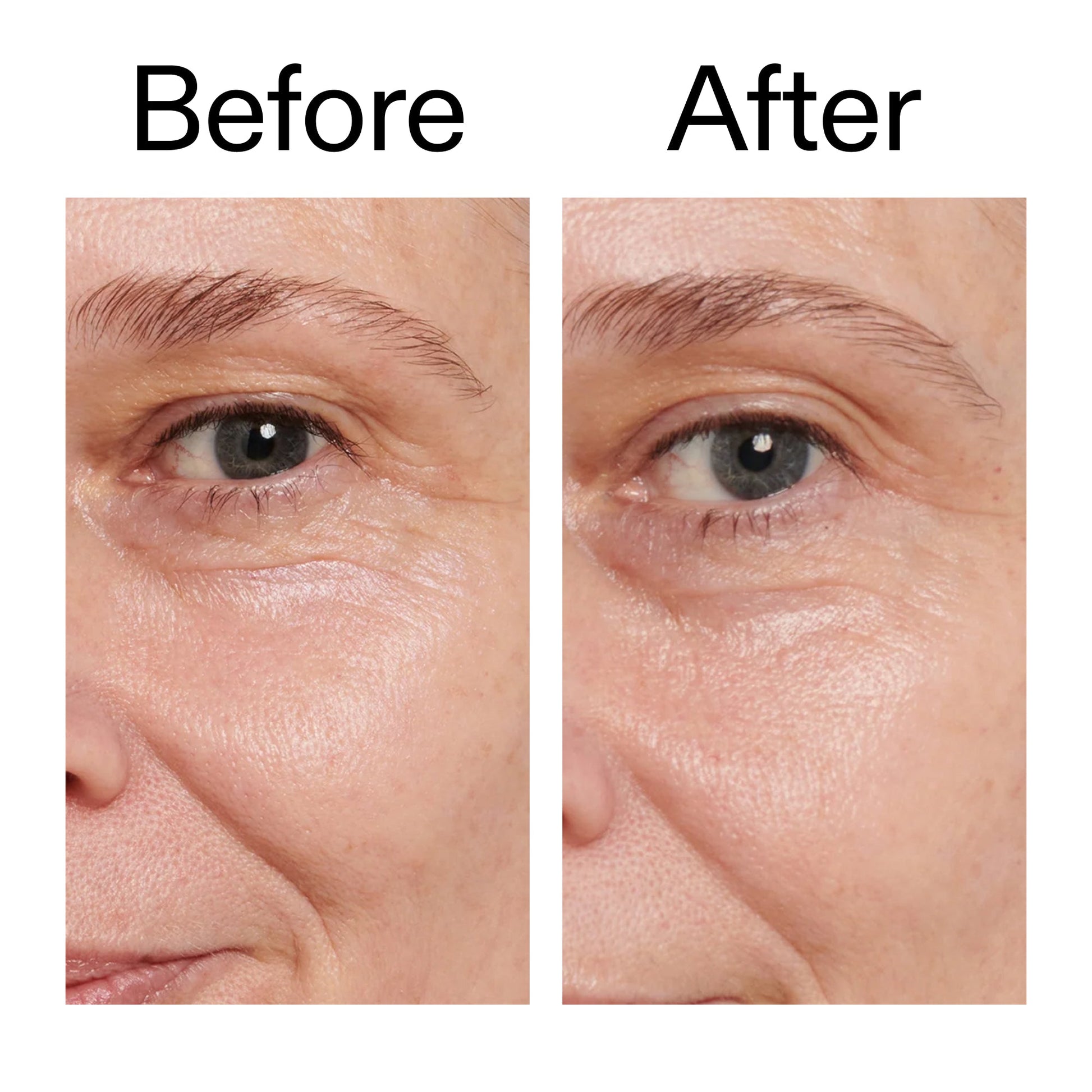 retinol-eye-cream-a4 Retinol_Eye_Cream_Before_After_2000x2000_ac03a80c-109e-4572-a95a-91dc109b4d27.jpg