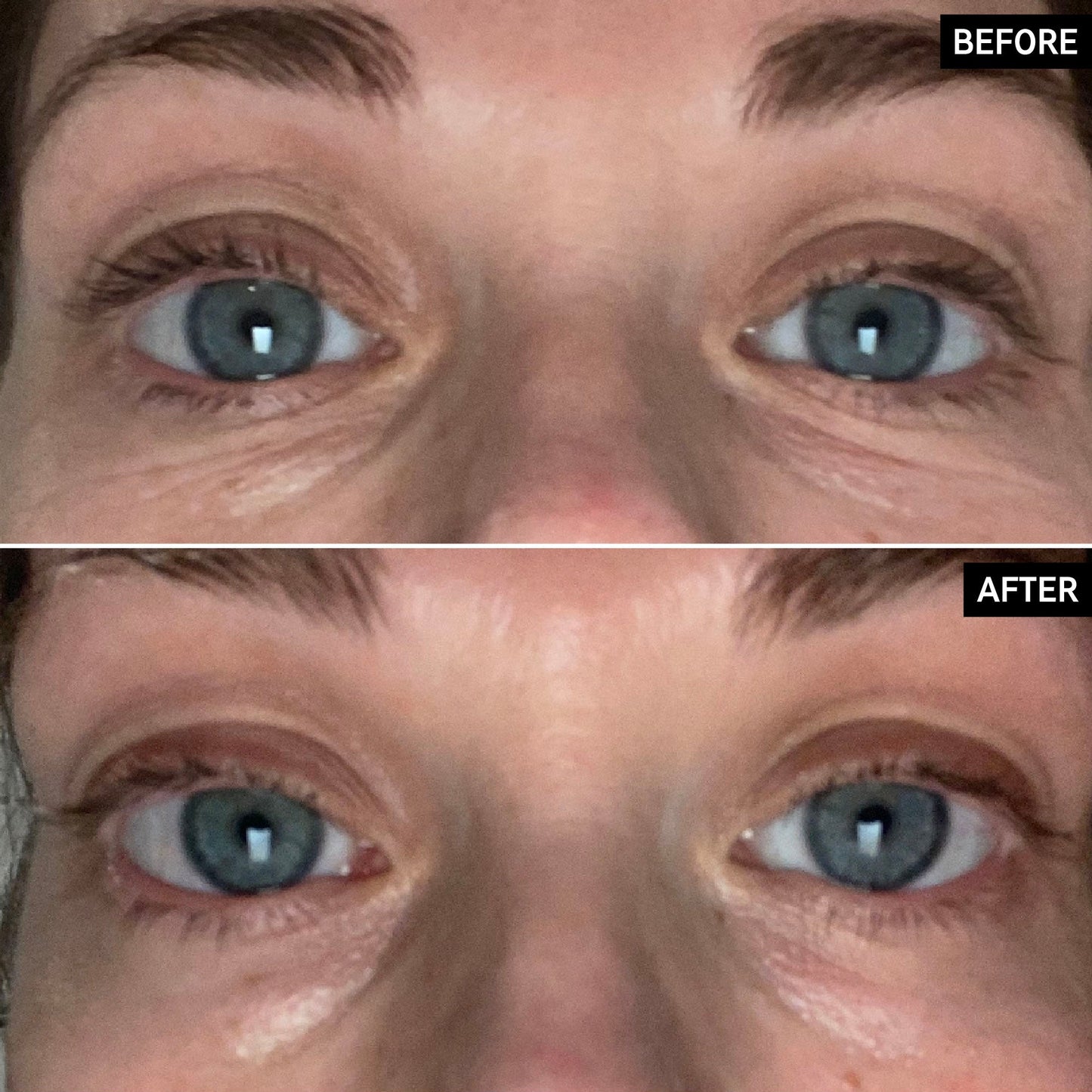 retinol-eye-cream-a4 SITE-UGCBAsApril_Nicole_B_A_PPage_2000x2000_1.jpg