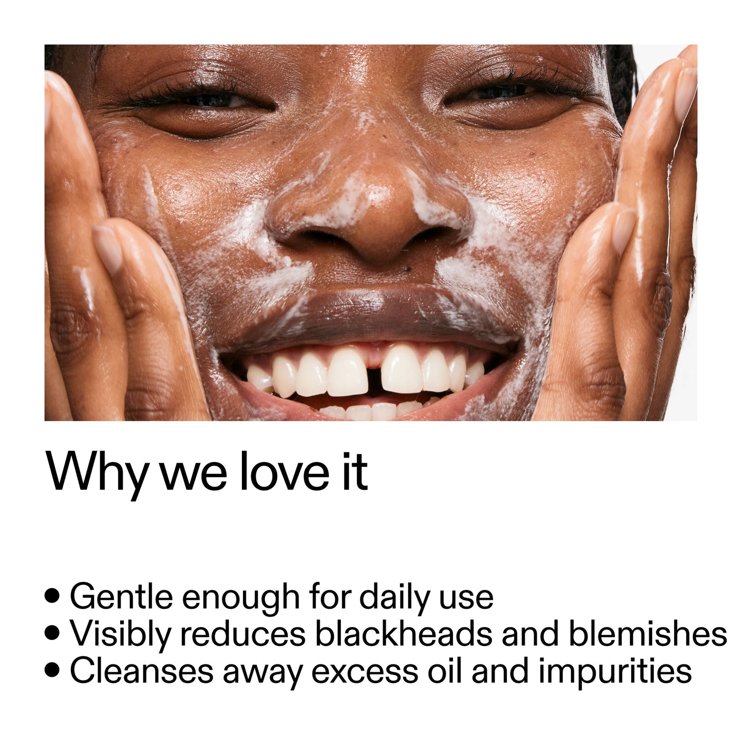 salicylic-acid-cleanser-150ml-w3 Salicylic_Acid_Cleanser_-_300mlWhy_we_love_it_2000x2000_87dc92a9-2559-4309-98cd-4e570f1be735.jpg
