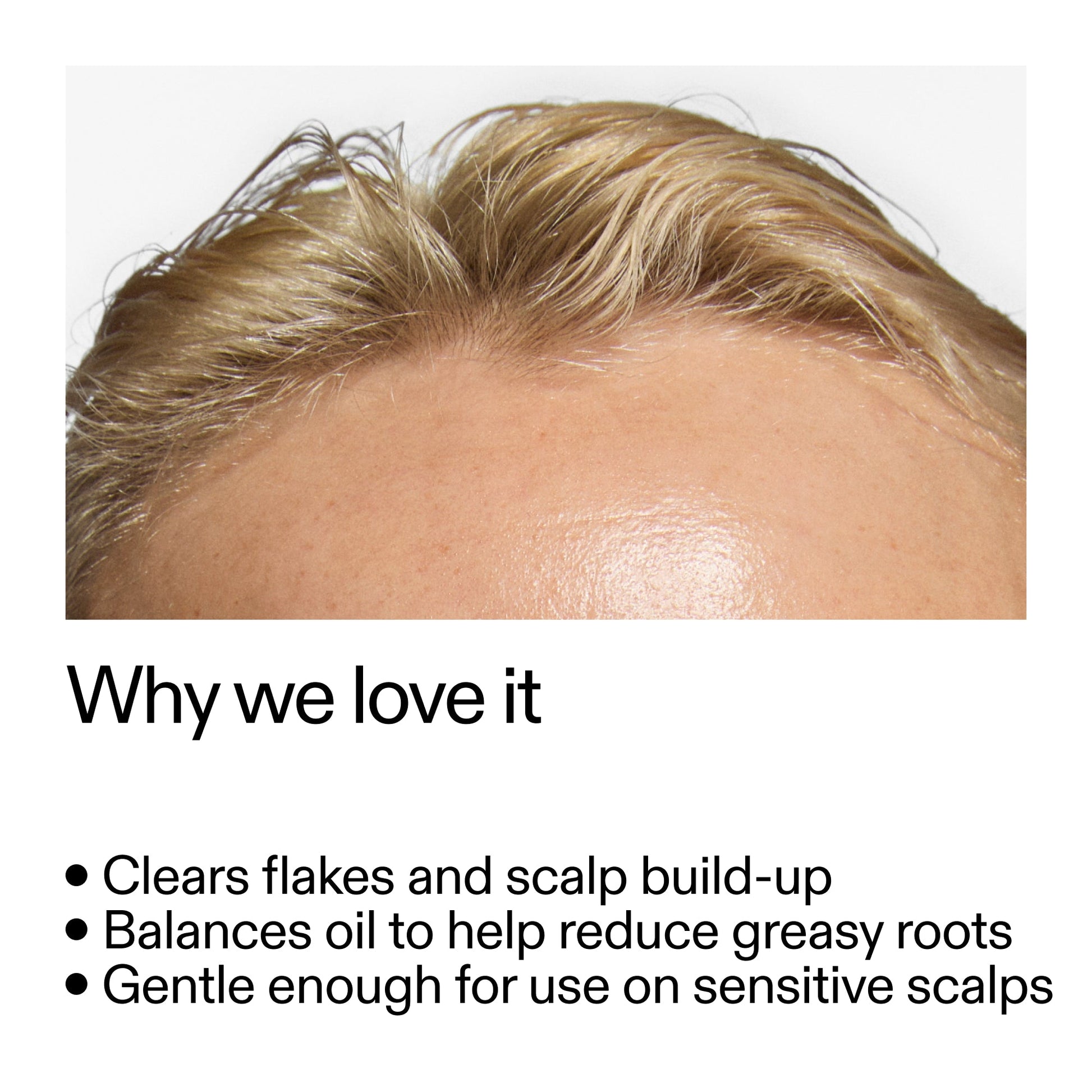 salicylic-acid-exfoliating-scalp-treatment-n7 Salicylic_Acid_Exfoliating_Scalp_Treatment_Why_we_love_it_2000x2000_44b6bd6d-9ec4-4b23-9dc4-bc3fd6f28e14.jpg