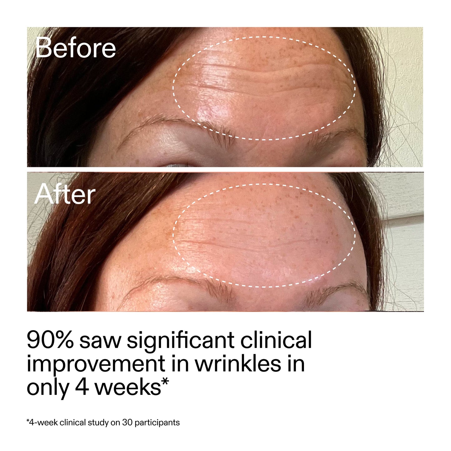starter-retinol-serum-duo-s0 StarterRetinol_BeforeAfter_Claim1_2000x2000_03b4d6e5-a357-43b9-a855-aba5e35c57f3.jpg