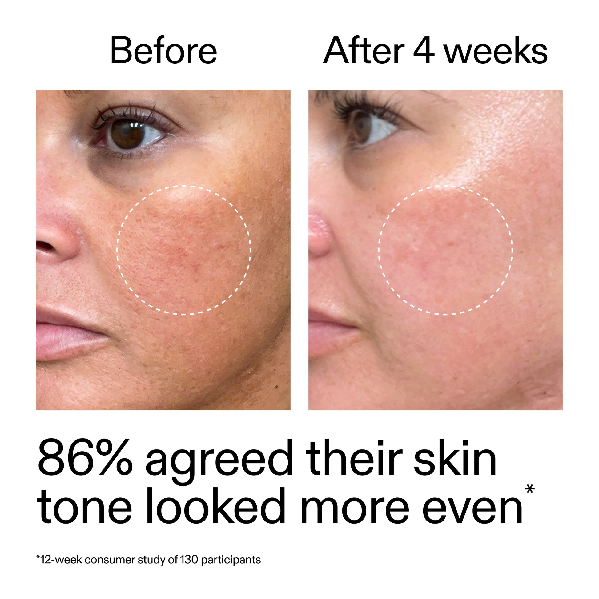 starter-retinol-serum-a3 StarterRetinol_BeforeAfter_Claim2_2000x2000_f5c9ecc0-8d76-429d-bef5-c3a61bcf5c09.jpg