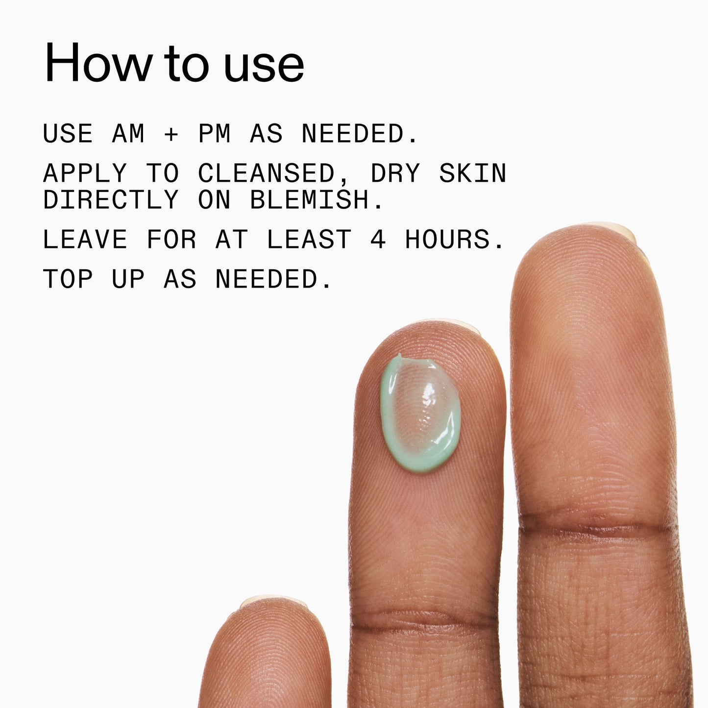 succinic-acid-acne-treatment-l0 Succinic_Acid_Treatment_How_to_Use_2000x2000_d57137d5-d7f1-427c-9a46-5fc00c19c542.jpg