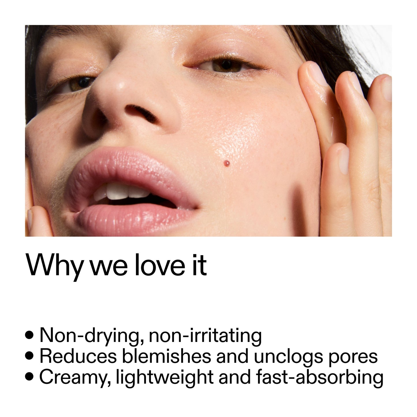 succinic-acid-acne-treatment-l0 Succinic_Acid_Treatment_Why_we_love_it_2000x2000_e90dd42a-cfe9-48b5-a2c7-d5eda787a6a8.jpg