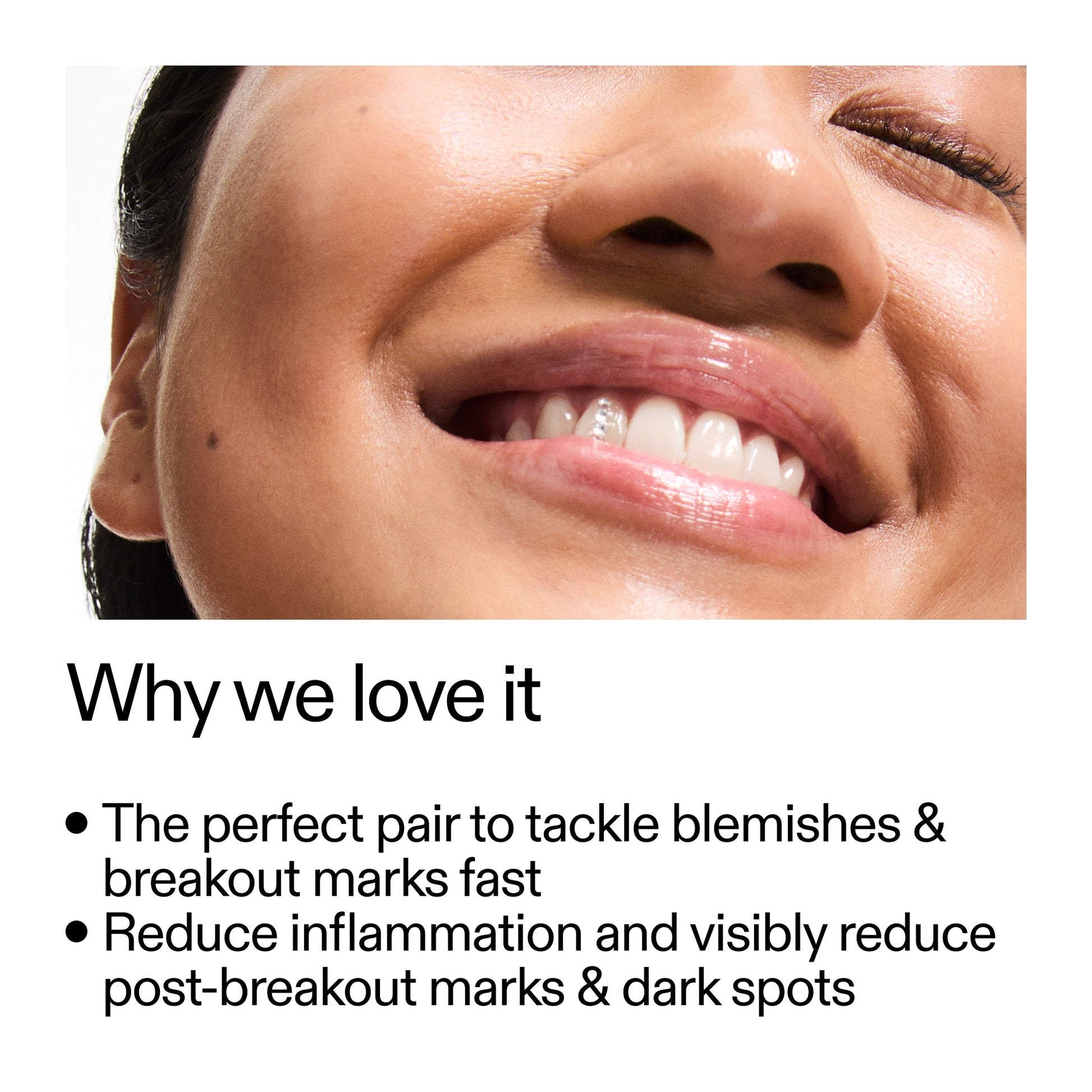 targeted-blemish-duo-y2 Targeted_Blemish_Duo_Why_we_love_it_2000x2000_ff00be46-438b-485f-b5c3-91e60bbb6919.jpg