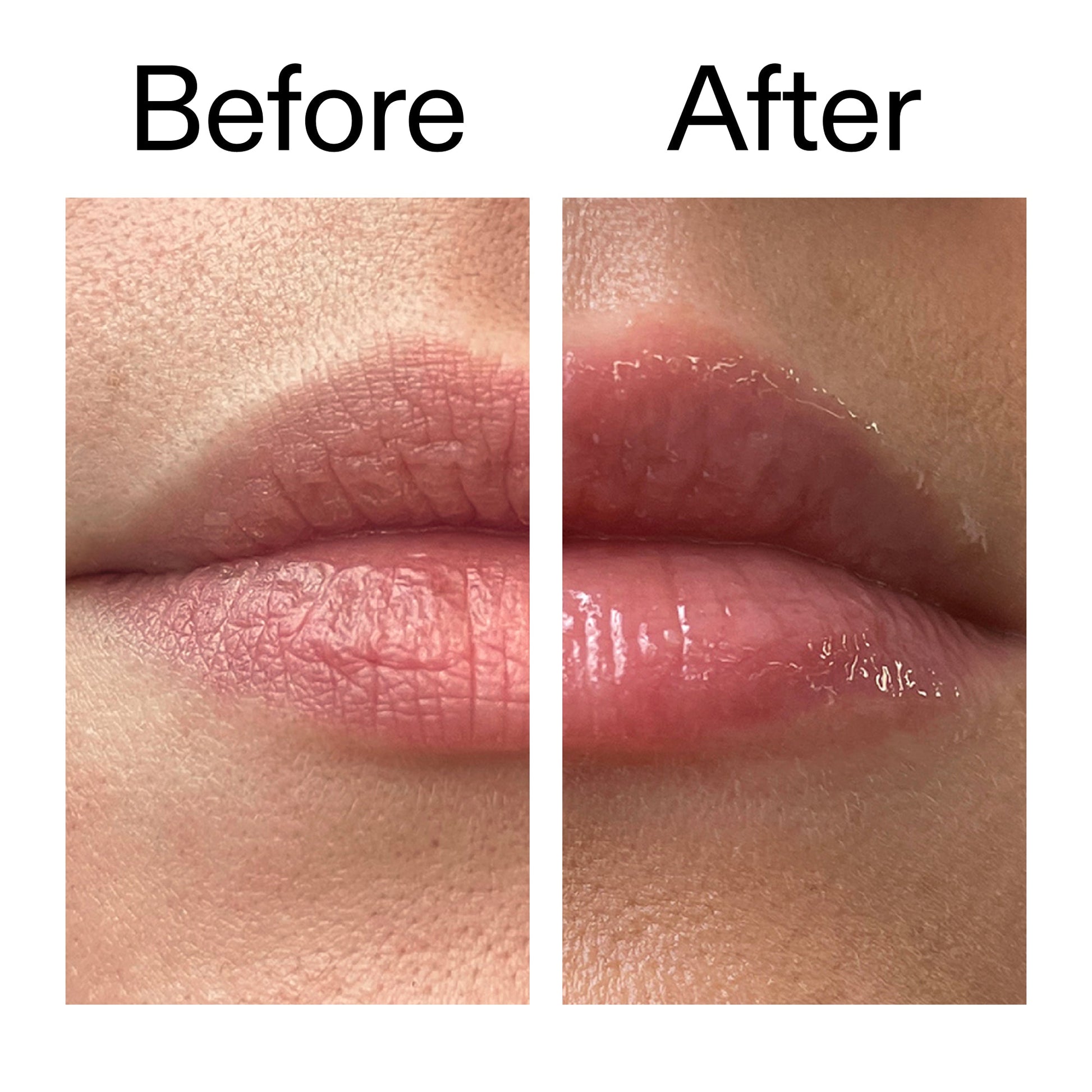tripeptide-plumping-lip-balm-y4 Tripeptide_Plumping_Lip_Balm_Before_After_2000x2000_b4a5ee04-d2ac-4857-8f01-17209acc4bf3.jpg