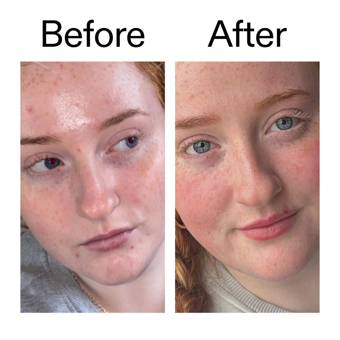 vitamin-b-c-and-e-moisturizer-f9 Vitamin_B_C_and_E_Moisturizer_Before_After_2000x2000_b0781a76-5ad2-4be9-95b8-ef92b356833c.jpg
